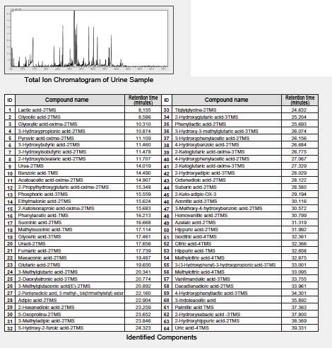 生物标记物搜索 | 使用GC / MS的代谢物成分数据库对尿液样品进行分析